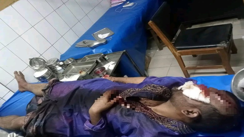 পাহাড় কাটা বন্ধের দাবিতে মানববন্ধনে হামলা: চুনতিতে সাইদুর র