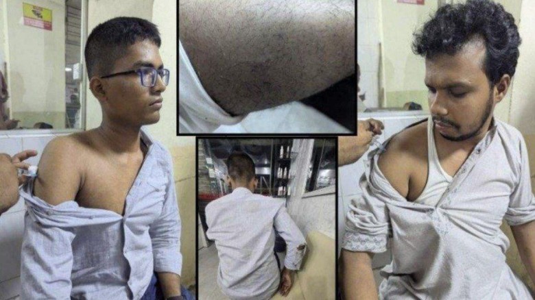 ‘কীসের সাংবাদিক’ বলেই হামলা চালায় ছাত্রদল নেতাকর্মীরা, আহত ঢ